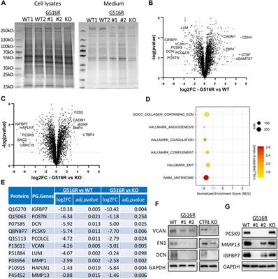 COG4 mutation in Saul-Wilson syndrome selectively affects secretion of proteins involved in chondrogenesis in chondrocyte-like cells